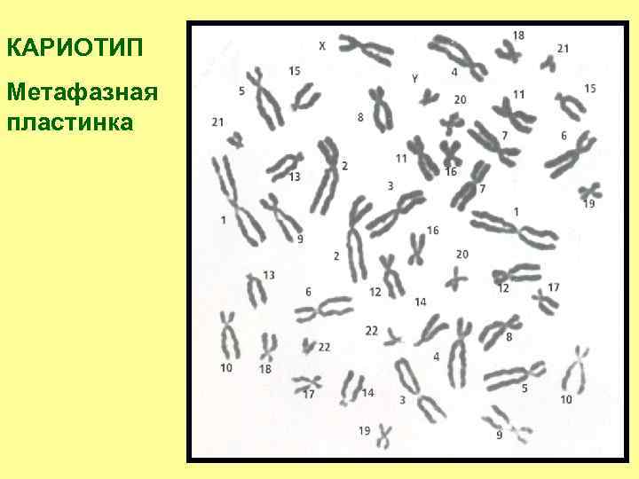 КАРИОТИП Метафазная пластинка 
