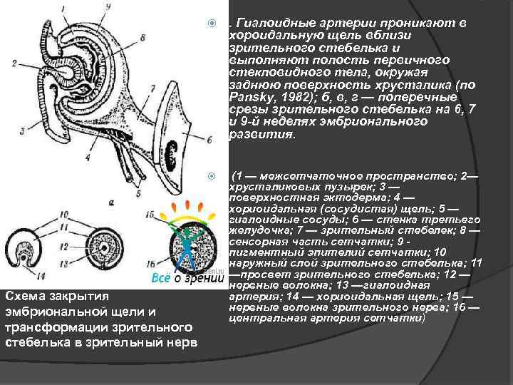  Схема закрытия эмбриональной щели и трансформации зрительного стебелька в зрительный нерв . Гиалоидные