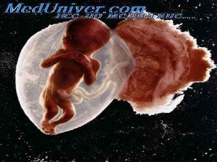 Эмбриогенез зрительного нерва и не только… 