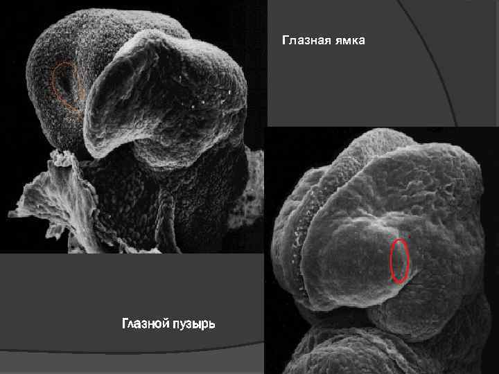 Глазная ямка Глазной пузырь 