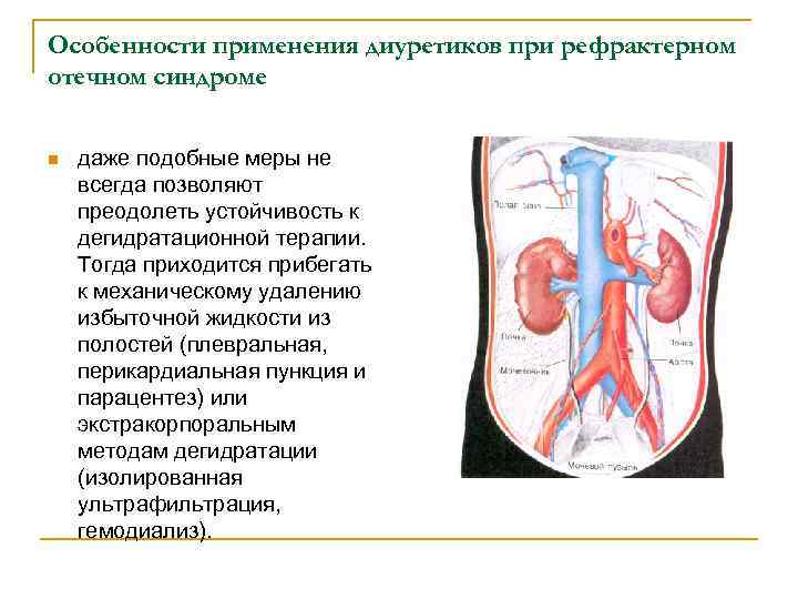 Особенности применения диуретиков при рефрактерном отечном синдроме n даже подобные меры не всегда позволяют