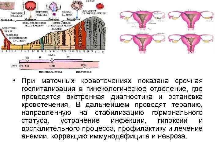  • При маточных кровотечениях показана срочная госпитализация в гинекологическое отделение, где проводятся экстренная