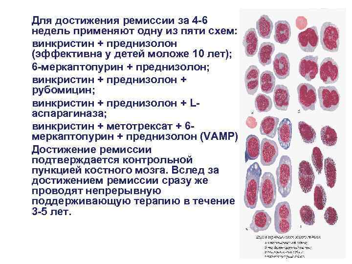  Для достижения ремиссии за 4 -6 недель применяют одну из пяти схем: винкристин