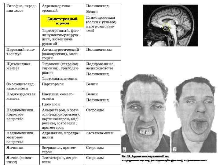 Саматотропный гормон 