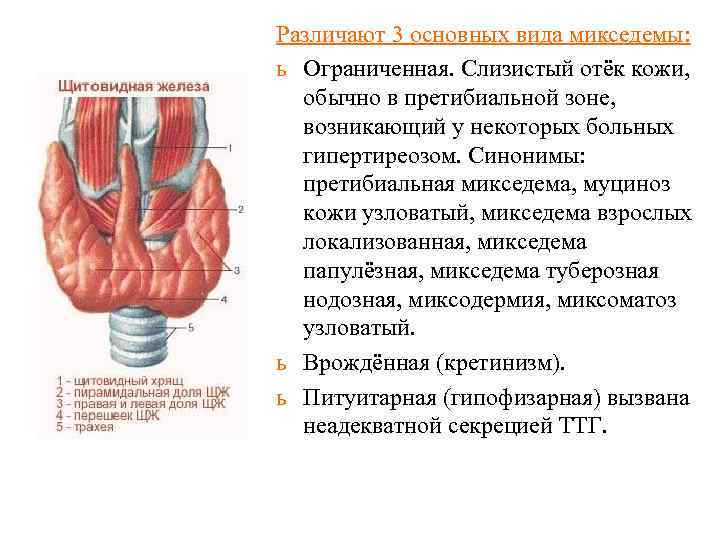 Различают 3 основных вида микседемы: ь Ограниченная. Слизистый отёк кожи, обычно в претибиальной зоне,