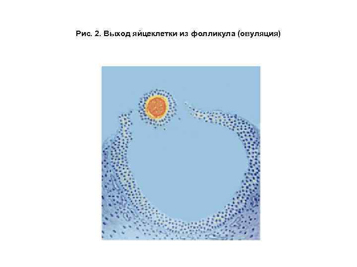 Рис. 2. Выход яйцеклетки из фолликула (овуляция) 