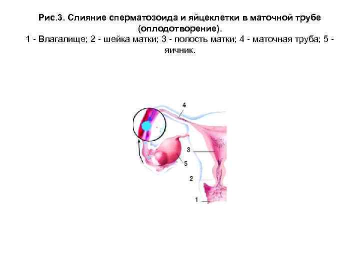 Рис. 3. Слияние сперматозоида и яйцеклетки в маточной трубе (оплодотворение). 1 - Влагалище; 2