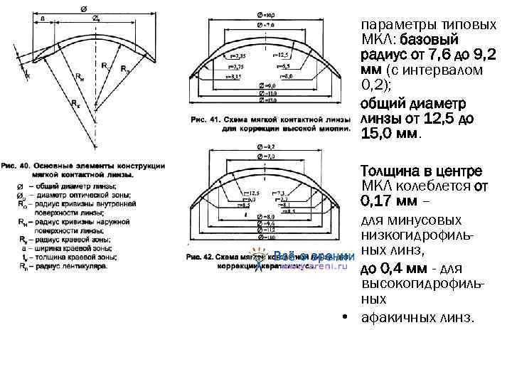  • параметры типовых МКЛ: базовый радиус от 7, 6 до 9, 2 мм