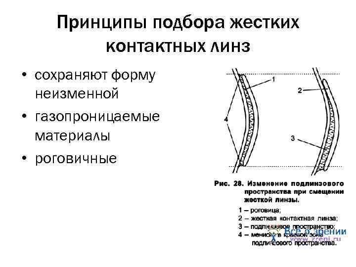 Принципы подбора жестких контактных линз • сохраняют форму неизменной • газопроницаемые материалы • роговичные