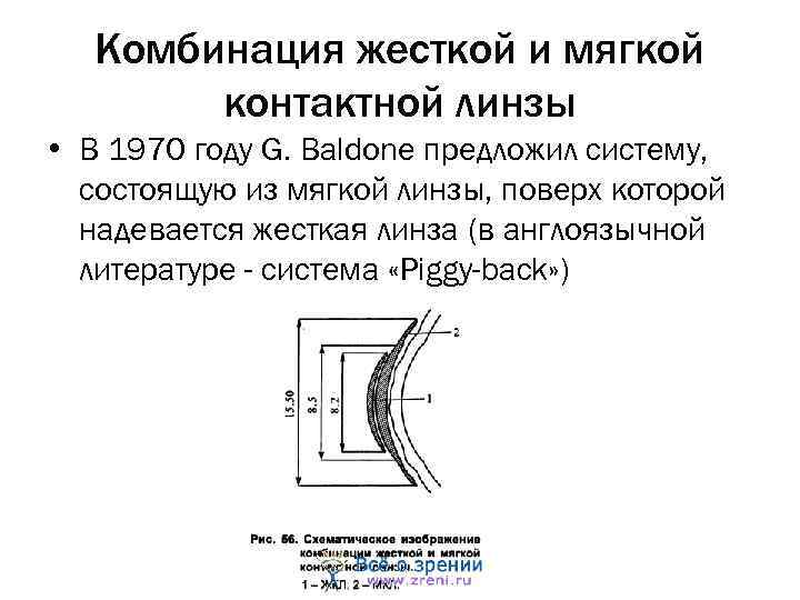 Комбинация жесткой и мягкой контактной линзы • В 1970 году G. Baldone предложил систему,