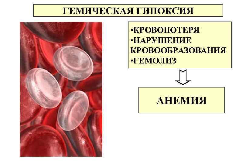 Гемическая гипоксия презентация