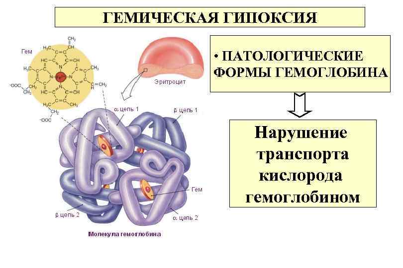 ГЕМИЧЕСКАЯ ГИПОКСИЯ • ПАТОЛОГИЧЕСКИЕ ФОРМЫ ГЕМОГЛОБИНА Нарушение транспорта кислорода гемоглобином 