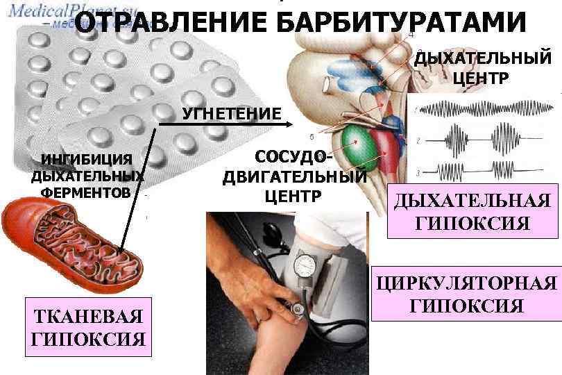 ОТРАВЛЕНИЕ БАРБИТУРАТАМИ ДЫХАТЕЛЬНЫЙ ЦЕНТР УГНЕТЕНИЕ ИНГИБИЦИЯ ДЫХАТЕЛЬНЫХ ФЕРМЕНТОВ ТКАНЕВАЯ ГИПОКСИЯ СОСУДОДВИГАТЕЛЬНЫЙ ЦЕНТР ДЫХАТЕЛЬНАЯ ГИПОКСИЯ