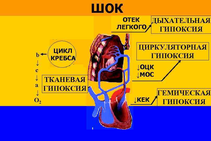 ШОК ОТЕК ДЫХАТЕЛЬНАЯ ЛЕГКОГО ГИПОКСИЯ ЦИКЛ КРЕБСА b ↓ c ↓ ТКАНЕВАЯ a ГИПОКСИЯ