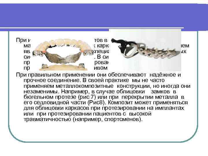 При использовании композитов в качестве облицовочного материала металлических каркасов, необходимым условием является использование специализированных