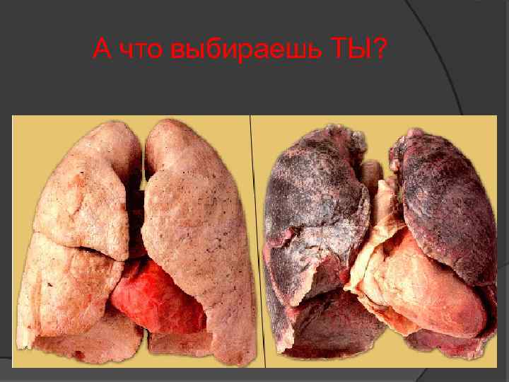 А что выбираешь ТЫ? 