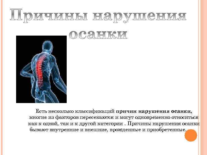 Есть несколько классификаций причин нарушения осанки, многие из факторов пересекаются и могут одновременно относиться