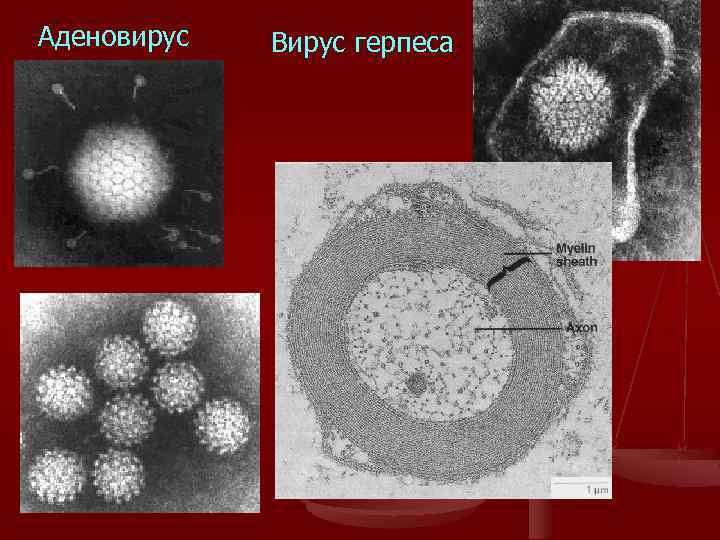 Аденовирус Вирус герпеса 
