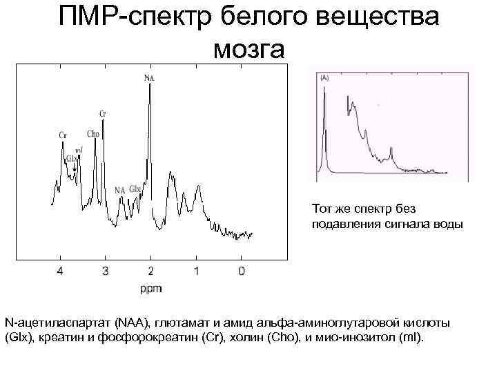 ПМР-спектр белого вещества мозга Тот же спектр без подавления сигнала воды N-ацетиласпартат (NAА), глютамат