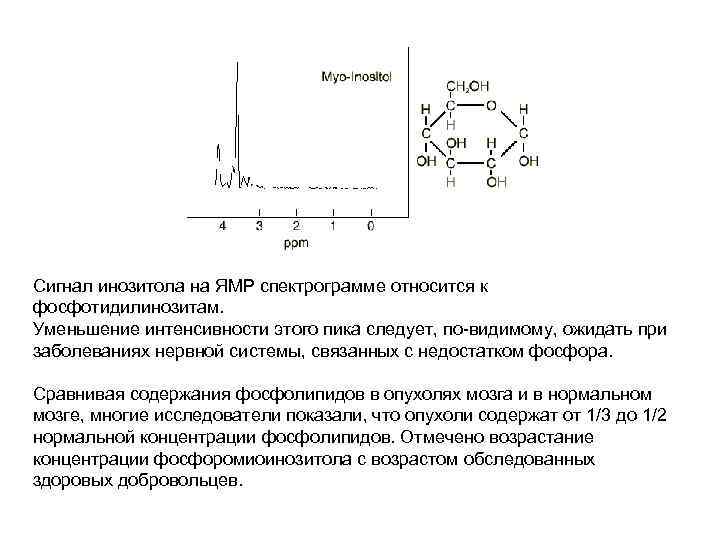 Сигнал инозитола на ЯМР спектрограмме относится к фосфотидилинозитам. Уменьшение интенсивности этого пика следует, по-видимому,