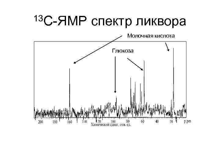 13 С-ЯМР спектр ликвора Молочная кислота Глюкоза 