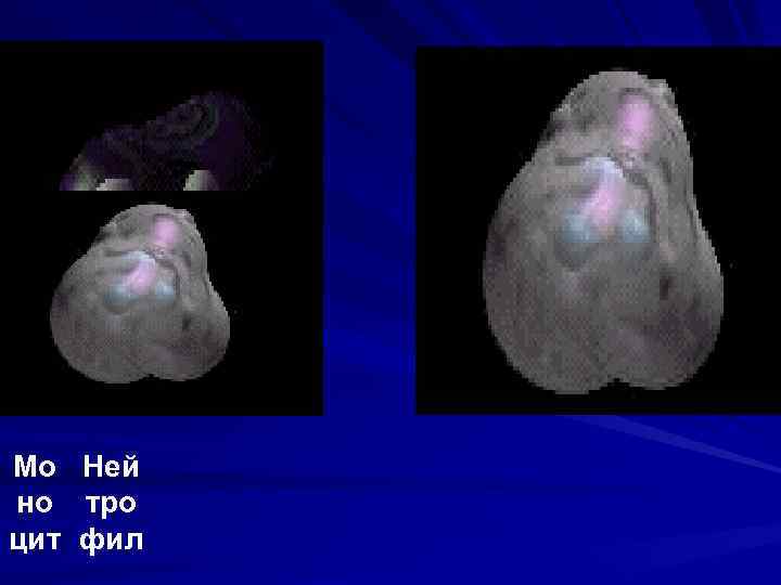 Мо Ней но тро цит фил 