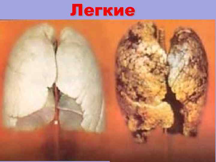Легкие 