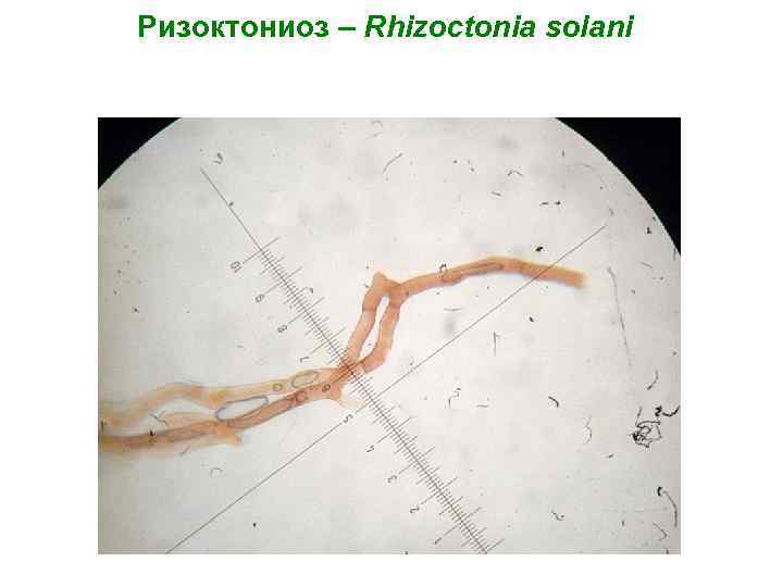 Ризоктониоз – Rhizoctonia solani 