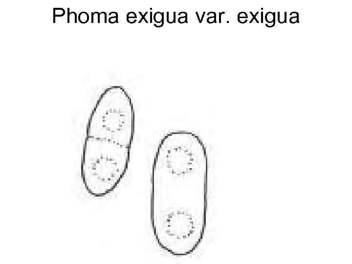 Phoma exigua var. exigua 
