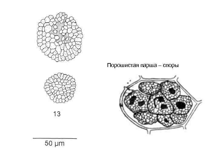 Порошистая парша – споры 