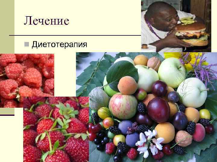 Лечение n Диетотерапия 