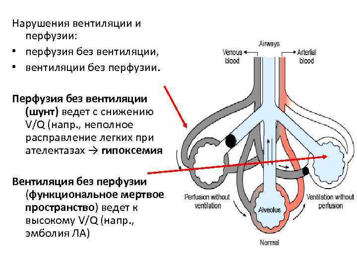 Легочная вентиляция составляет