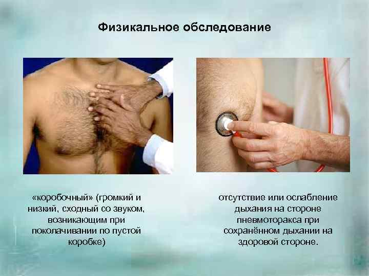 Физикальное обследование «коробочный» (громкий и низкий, сходный со звуком, возникающим при поколачивании по пустой