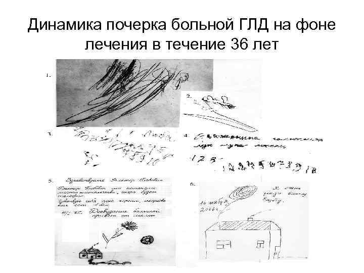 Динамика почерка больной ГЛД на фоне лечения в течение 36 лет 