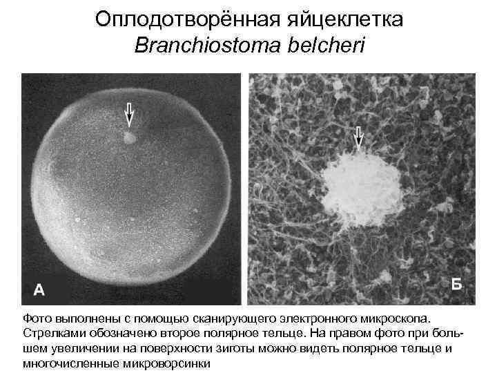 Оплодотворённая яйцеклетка Branchiostoma belcheri Фото выполнены с помощью сканирующего электронного микроскопа. Стрелками обозначено второе