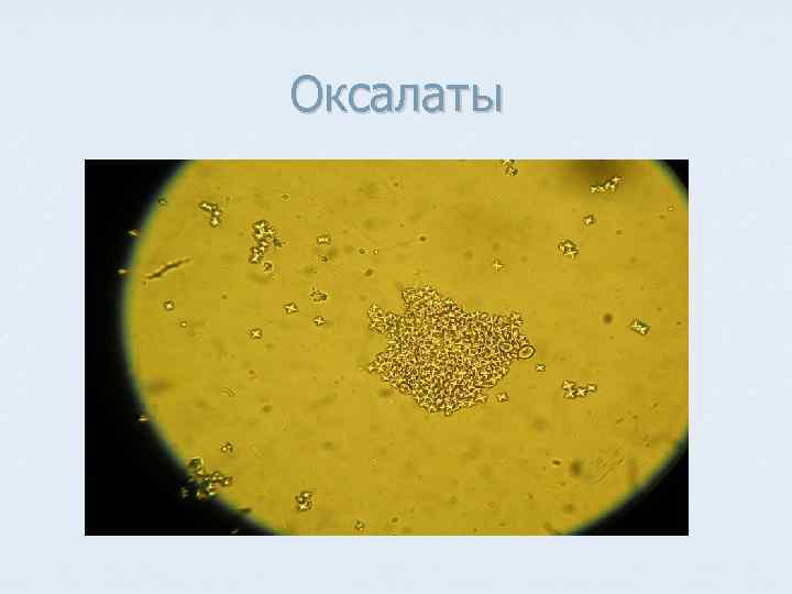 Оксалаты 