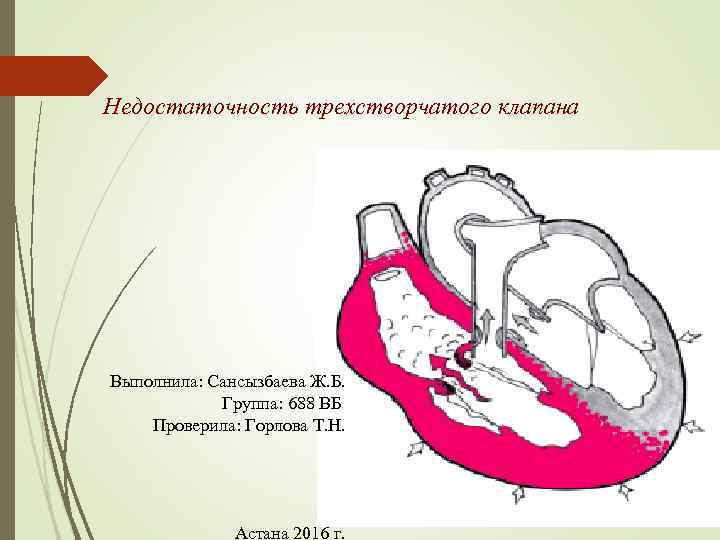 Недостаточность трехстворчатого клапана Выполнила: Сансызбаева Ж. Б. Группа: 688 ВБ Проверила: Горлова Т. Н.