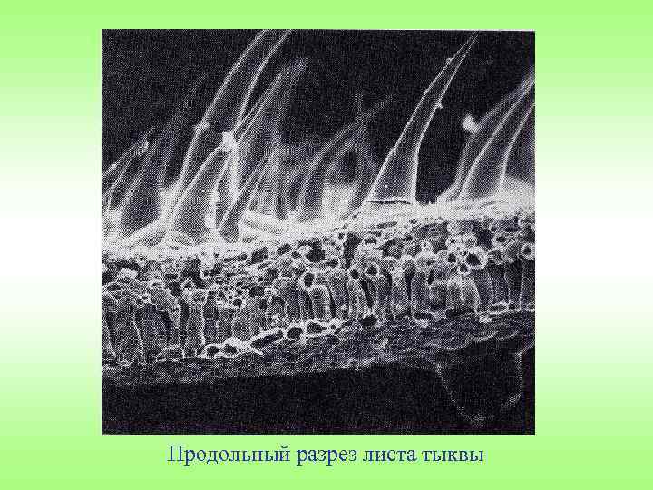 Продольный разрез листа тыквы 