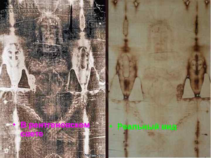  • В рентгеновском свете • Реальный вид 