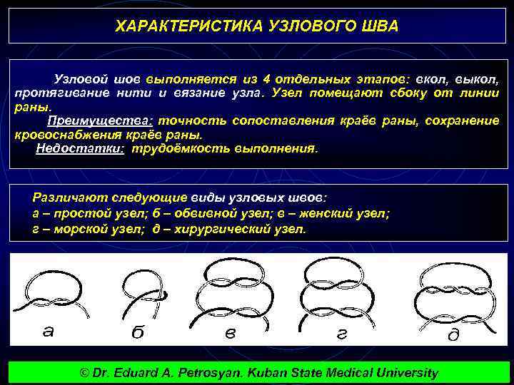 ХАРАКТЕРИСТИКА УЗЛОВОГО ШВА Узловой шов выполняется из 4 отдельных этапов: вкол, выкол, протягивание нити