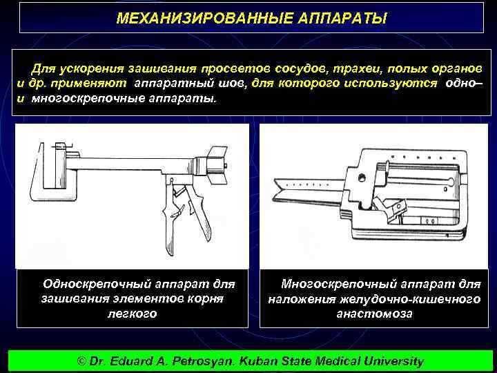 МЕХАНИЗИРОВАННЫЕ АППАРАТЫ Для ускорения зашивания просветов сосудов, трахеи, полых органов и др. применяют аппаратный
