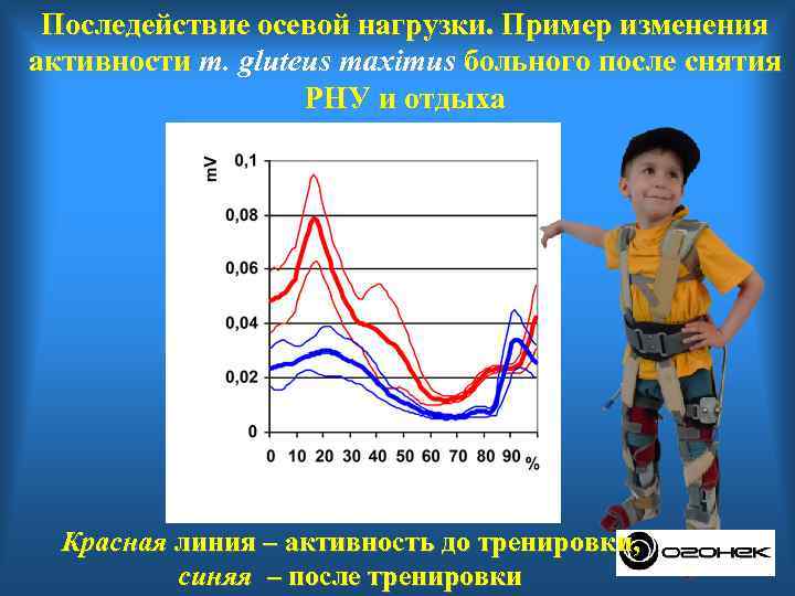 Активность м. Г/М активность что это. Двигательный режим с ограничением осевых нагрузок. Последействие пример.