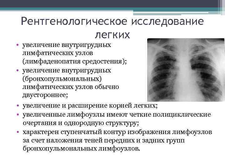 Рентгенологическое исследование легких • увеличение внутригрудных лимфатических узлов (лимфаденопатия средостения); • увеличение внутригрудных (бронхопульмональных)