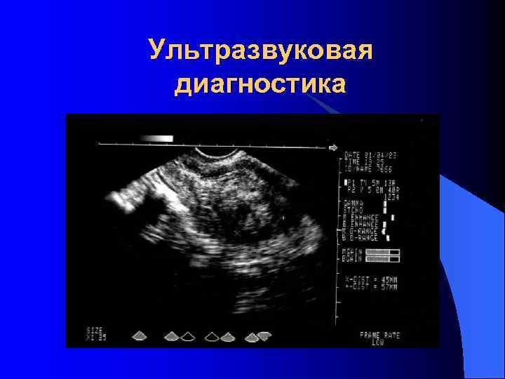 Ультразвуковая диагностика 