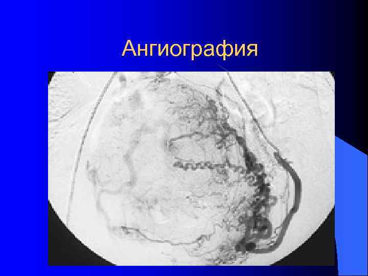 Ангиография 