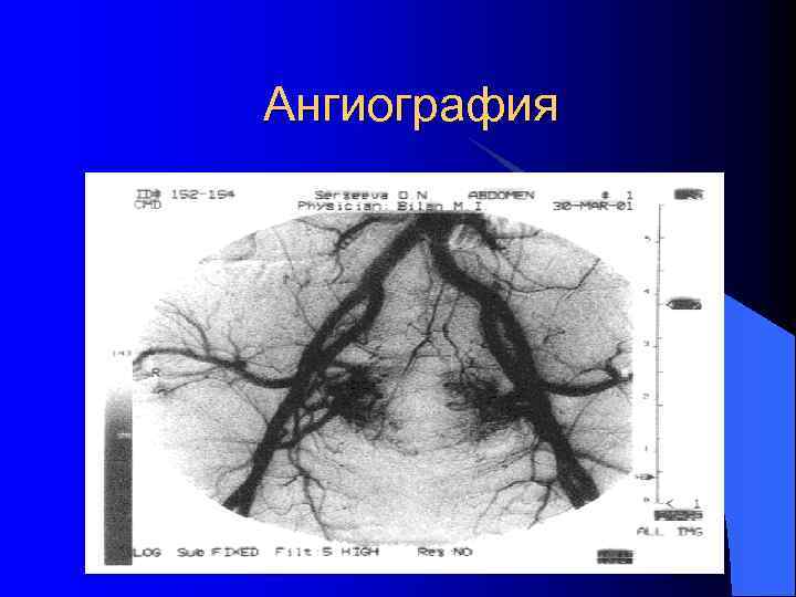 Ангиография 