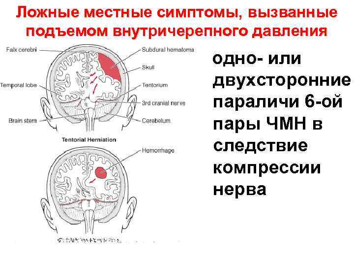 Более вероятно сосудистого генеза