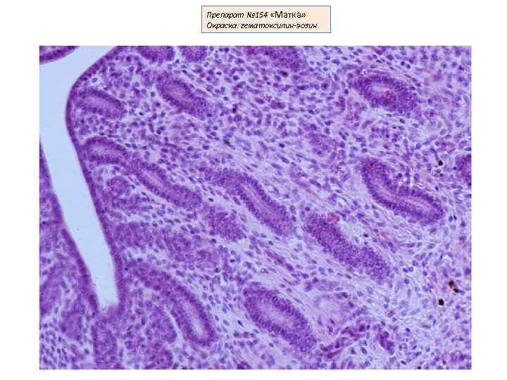 Матка гистология препарат рисунок