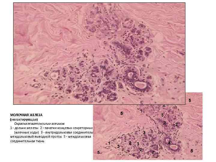 Молочная железа схема гистология