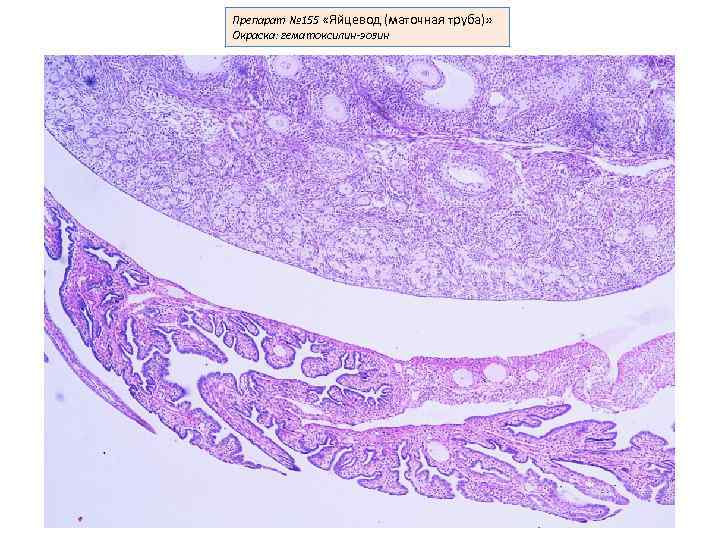 Маточная труба гистология рисунок